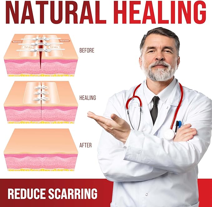 Emergency Wound Closure Strips - 4pk - 2 Types Laceration Closure Kit - Stitchless & Easy to Use - Butterfly Bandages