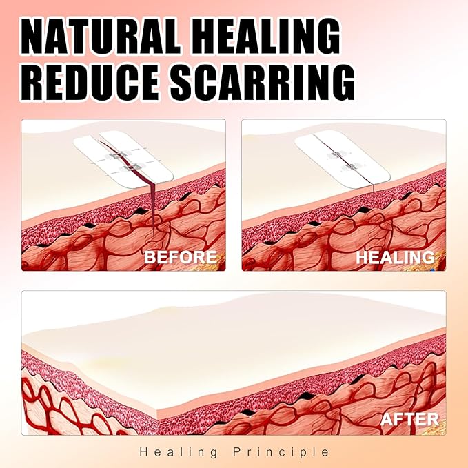 Carbou Emergency Wound Closure Strips - 4 Pcs - Zip Stitch Butterfly Bandaids - Laceration Closure Kit - Stitchless & Easy to Use