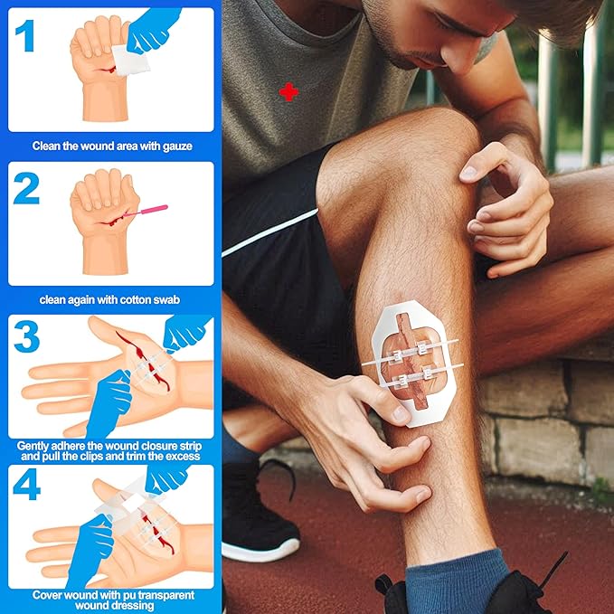 Zip Stitch Wound Closure Kit – 3 Set 12 Pcs Emergency Butterfly Bandages – No Stitch Laceration Closure Strips –Wound Sealing Kit for First Aid, Hiking, Survival